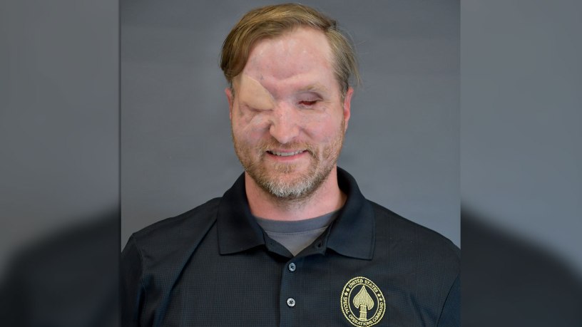 Fomer U.S. Army Special Operations Maj. Jonathan Turnbull, gravely injured in ISIS suicide bombing in Syria in 2019, is aiming to win the 2026 Warrior Games Ultimate Championship in San Antonio, Texas.